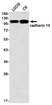 Cadherin 10 Rabbit mAb Antibody