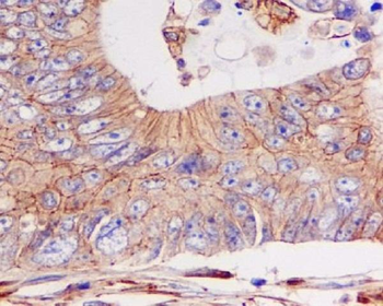 Cadherin Rabbit mAb