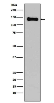 Cadherin Rabbit mAb
