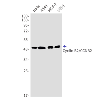 Cyclin B2 Rabbit mAb Antibody