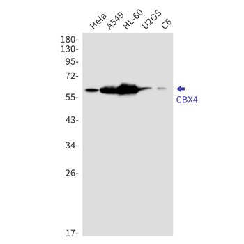 CBX4 Rabbit mAb Antibody