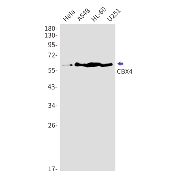 CBX4 Rabbit mAb Antibody