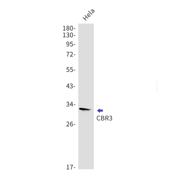 CBR3 Rabbit mAb Antibody