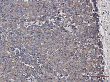 CARS Rabbit mAb Antibody