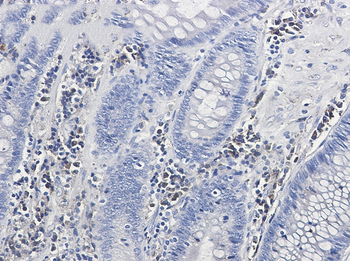 Calumenin Rabbit Monoclonal Antibody