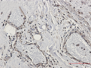 CAB39 Rabbit mAb