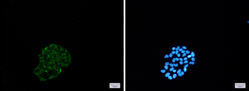 BNIP3 Rabbit mAb Antibody