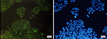 c IAP1 Rabbit mAb Antibody