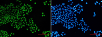 Bcl2 L14 Rabbit mAb Antibody