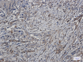 ATG4C Rabbit mAb Antibody