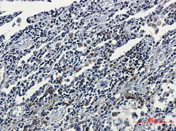 ATF6 Rabbit mAb Antibody
