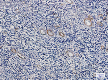 Asparagine Synthetase Rabbit mAb Antibody
