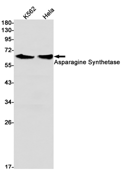 Asparagine Synthetase Rabbit mAb