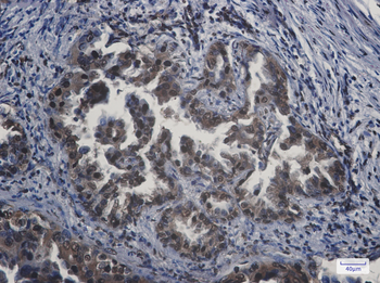 APPL Rabbit mAb Antibody