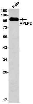 APLP2 Rabbit mAb Antibody