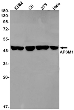 AP3M1 Rabbit mAb Antibody