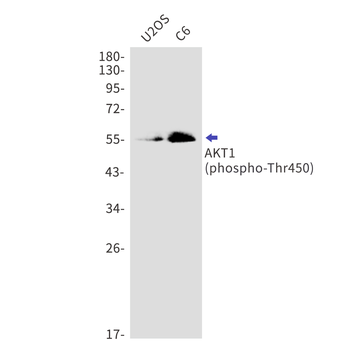 Phospho-AKT1 (Thr450) Rabbit mAb