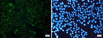 Aryl Hydrocarbon Receptor Rabbit mAb Antibody