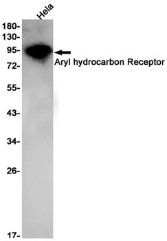 Aryl Hydrocarbon Receptor Rabbit mAb Antibody