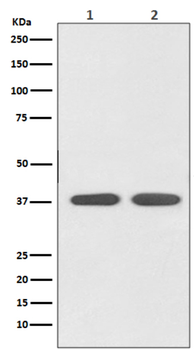 Angiotensin II Type 1 Receptor Rabbit mAb Antibody