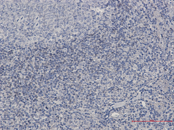 ADK Rabbit mAb Antibody