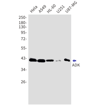 ADK Rabbit mAb Antibody