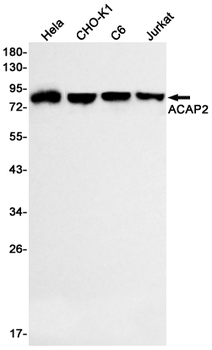 ACAP2 Rabbit mAb Antibody
