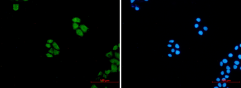 Wnt5a Rabbit mAb Antibody