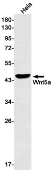 Wnt5a Rabbit mAb Antibody