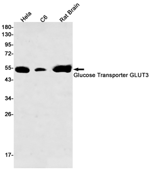 Glucose Transporter GLUT3 Rabbit mAb Antibody