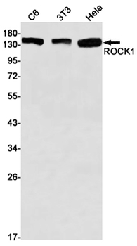 ROCK1 Rabbit mAb Antibody