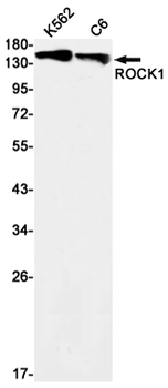 ROCK1 Rabbit mAb Antibody