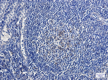 Relaxin 2 Rabbit mAb Antibody