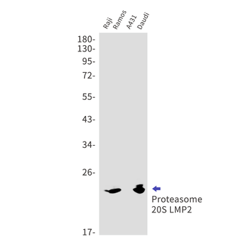 Proteasome beta 9 Rabbit mAb Antibody