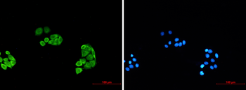 Proteasome alpha 6 Rabbit mAb Antibody