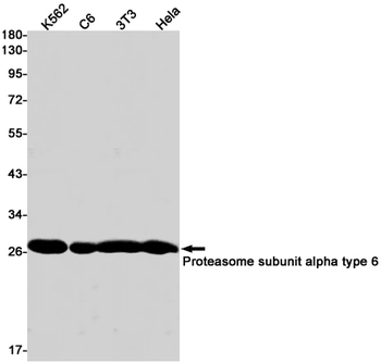 Proteasome alpha 6 Rabbit mAb Antibody