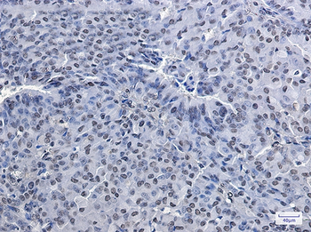PRMT1 Rabbit mAb Antibody