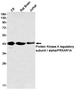 PKA RI alpha Rabbit mAb Antibody