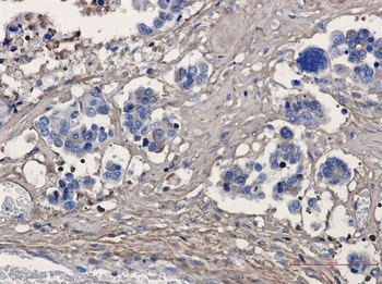 Periostin Rabbit mAb Antibody