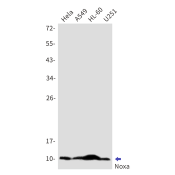 NOXA Rabbit mAb Antibody