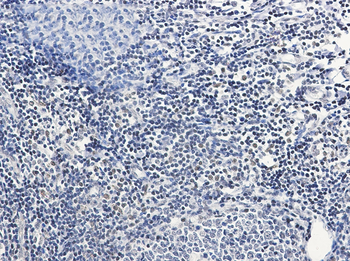 PIM1 Rabbit mAb Antibody