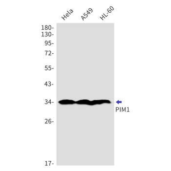 PIM1 Rabbit mAb Antibody