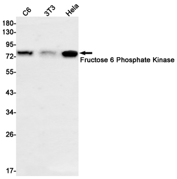Fructose 6 Phosphate Kinase Rabbit mAb Antibody