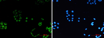 PACSIN3 Rabbit mAb