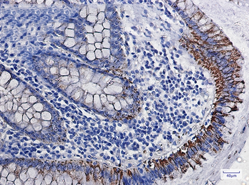Monoamine Oxidase A Rabbit mAb Antibody