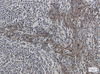 Hsp70 1B Rabbit mAb Antibody