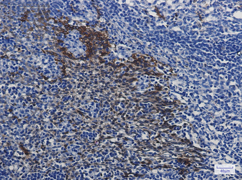 Hsp70 1A Rabbit mAb Antibody
