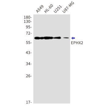 Epoxide Hydrolase 1 Rabbit mAb Antibody