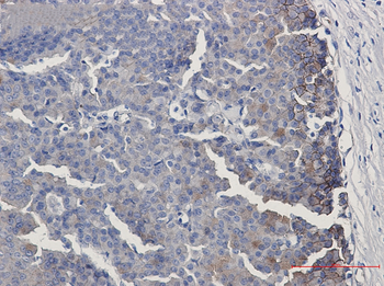 Ephrin Receptor B4 Rabbit mAb Antibody