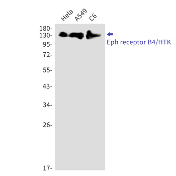 Ephrin Receptor B4 Rabbit mAb Antibody